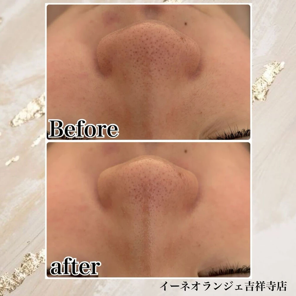 ブログ